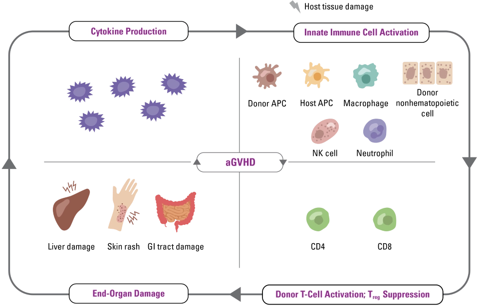 Pathogenesis of aGVHD chart