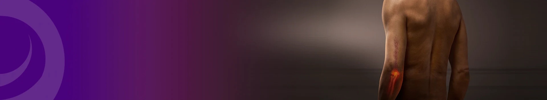 Campaign image of man with skin rash transforming into joint pain in elbow